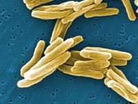 Иммунология туберкулеза